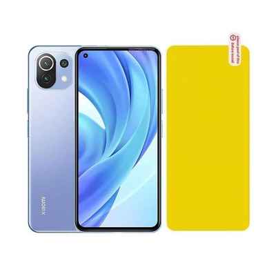 محافظ پشت مات بدنه Xiaomi 11 Lite 5G Back Nano Body Protector